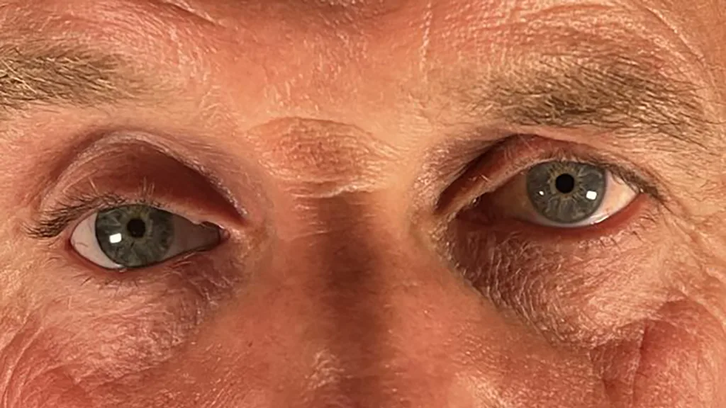 Augen